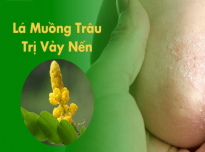 Có nên sử dụng cây muồng trâu trị vảy nến hay không?